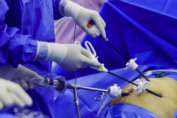 Laparoscopy